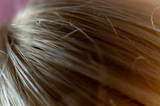 Biotin